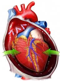 low cardiac output syndrome